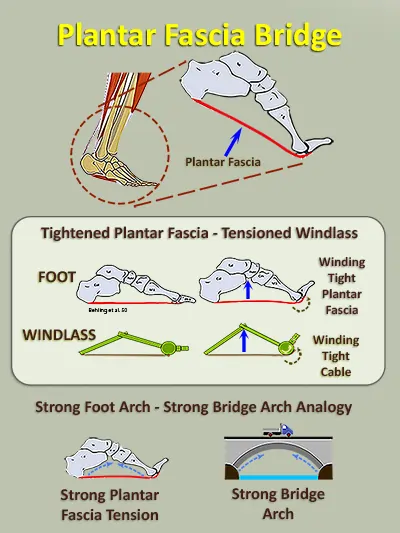 Diagram and schematics of the plantar fascia winched into a tight cable providing arch strength like a strong bridge arch.  This is one of the mechanical advantages contributing to the kinetic chain of the punch technique.